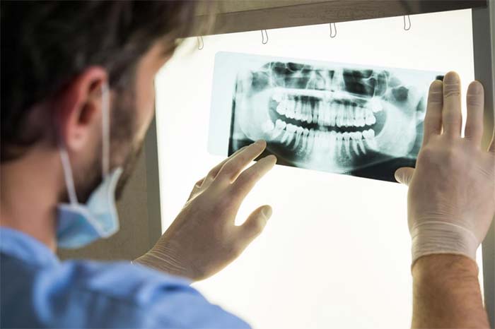 Dentist Examining a Dental X-Ray in Boise, ID