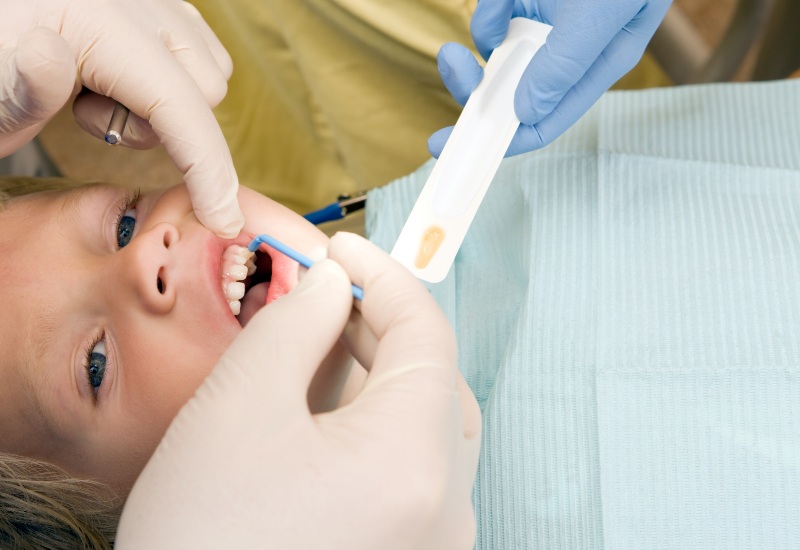 Dentist Providing Fluoride Treatment for a Patient in Boise, ID